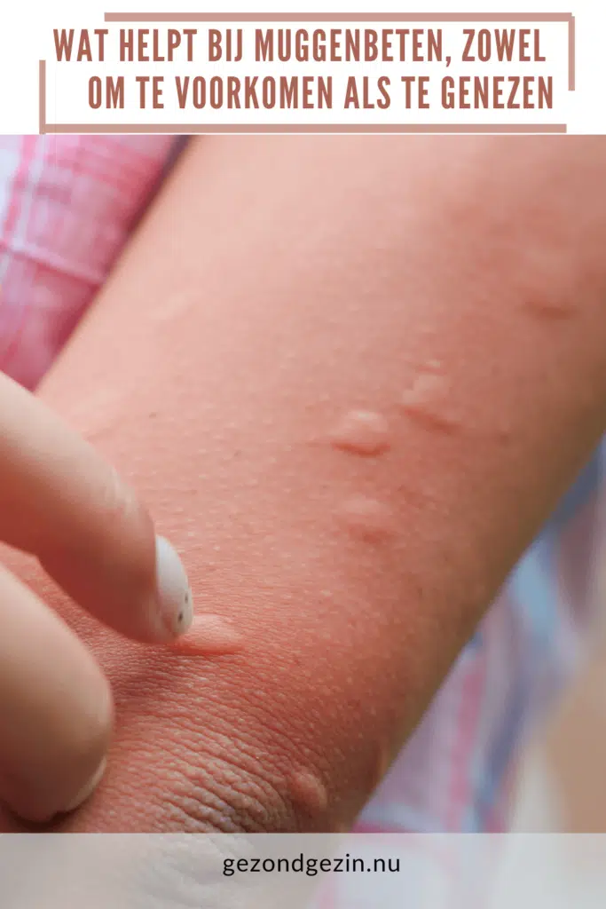 arm met muggenbulten om te bewaren op Pinterest